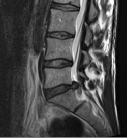 BS-vorfall BS-vorfall